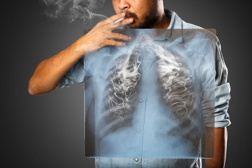 Το κάπνισμα έχει επιζήμια επίδραση στο ανθρώπινο σώμα